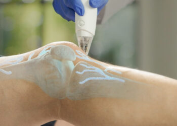 iovera°: A “Cool Solution” for OA Pain 